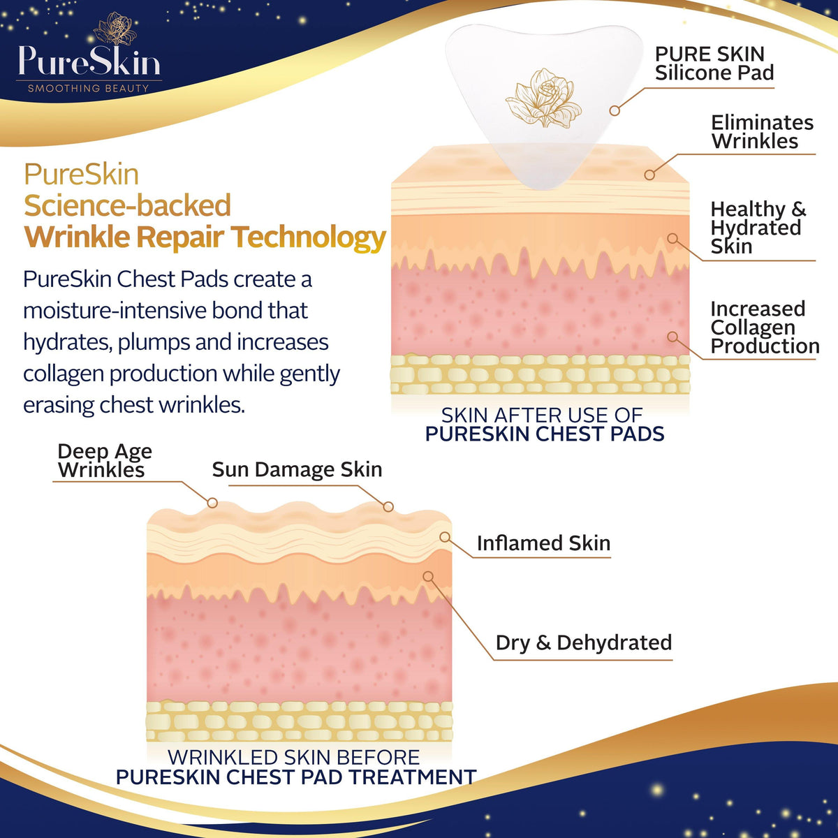 Say Goodbye to your Chest Wrinkles & Hello to PureSkin-Chest Wr...